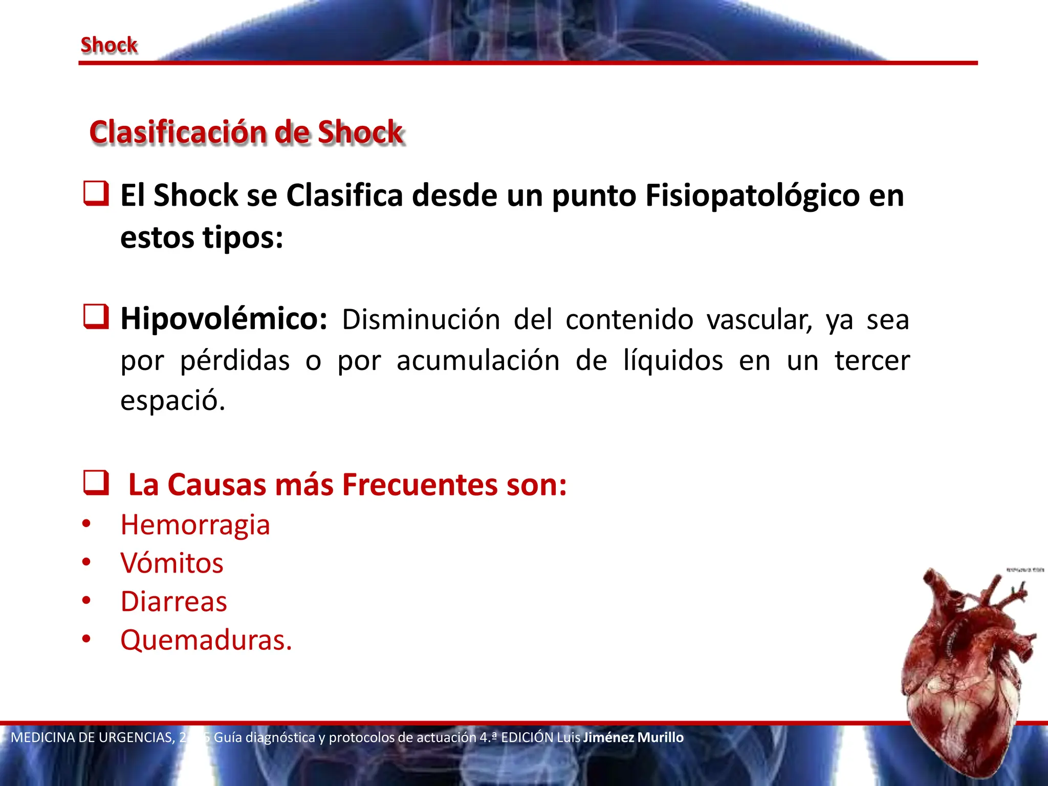 TIPOS DE SHOCK, HIPOVOLEMICO, CARDIOGENICO, DISTRIBUTIVO, ETC | PPTX