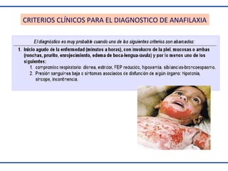 CRITERIOS CLÍNICOS PARA EL DIAGNOSTICO DE ANAFILAXIA

 