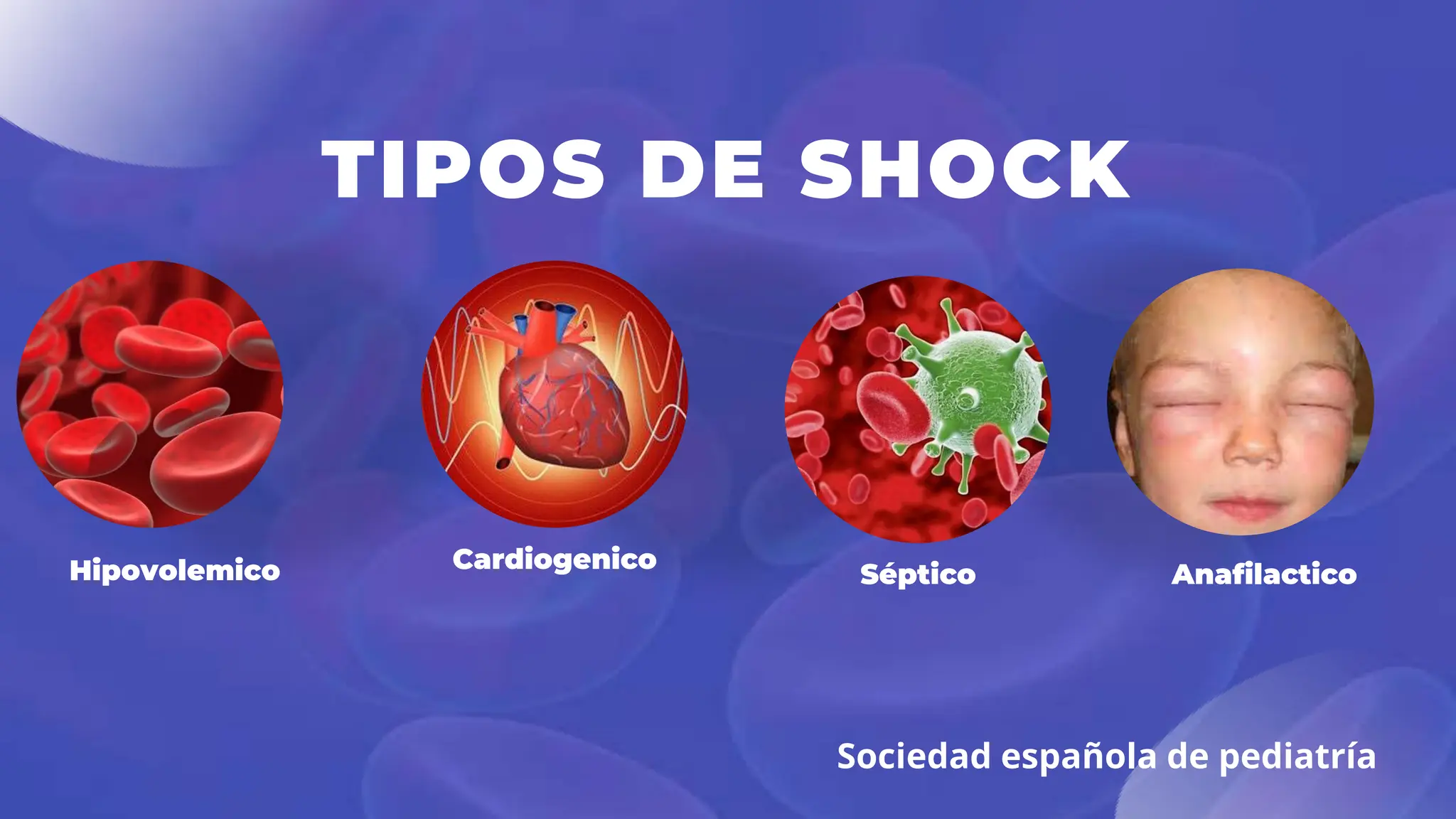 shock hipovolemico en pediatría... lo más sencillo de como actúar ante ...
