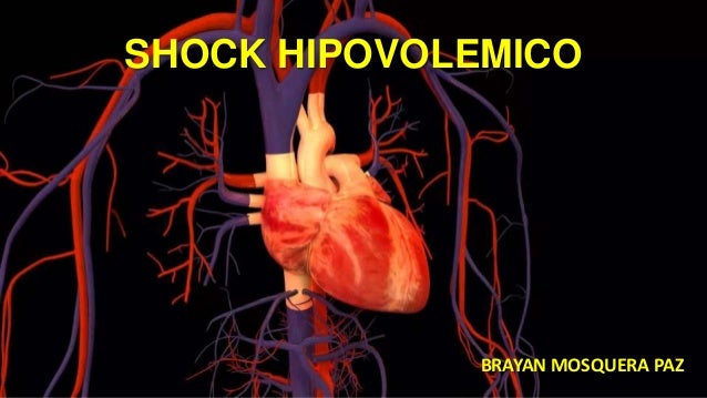 Shock hipovolemico
