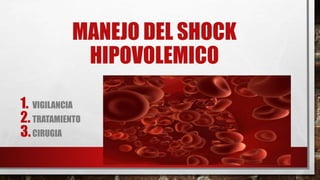 Shock hipovolemico | PPTX
