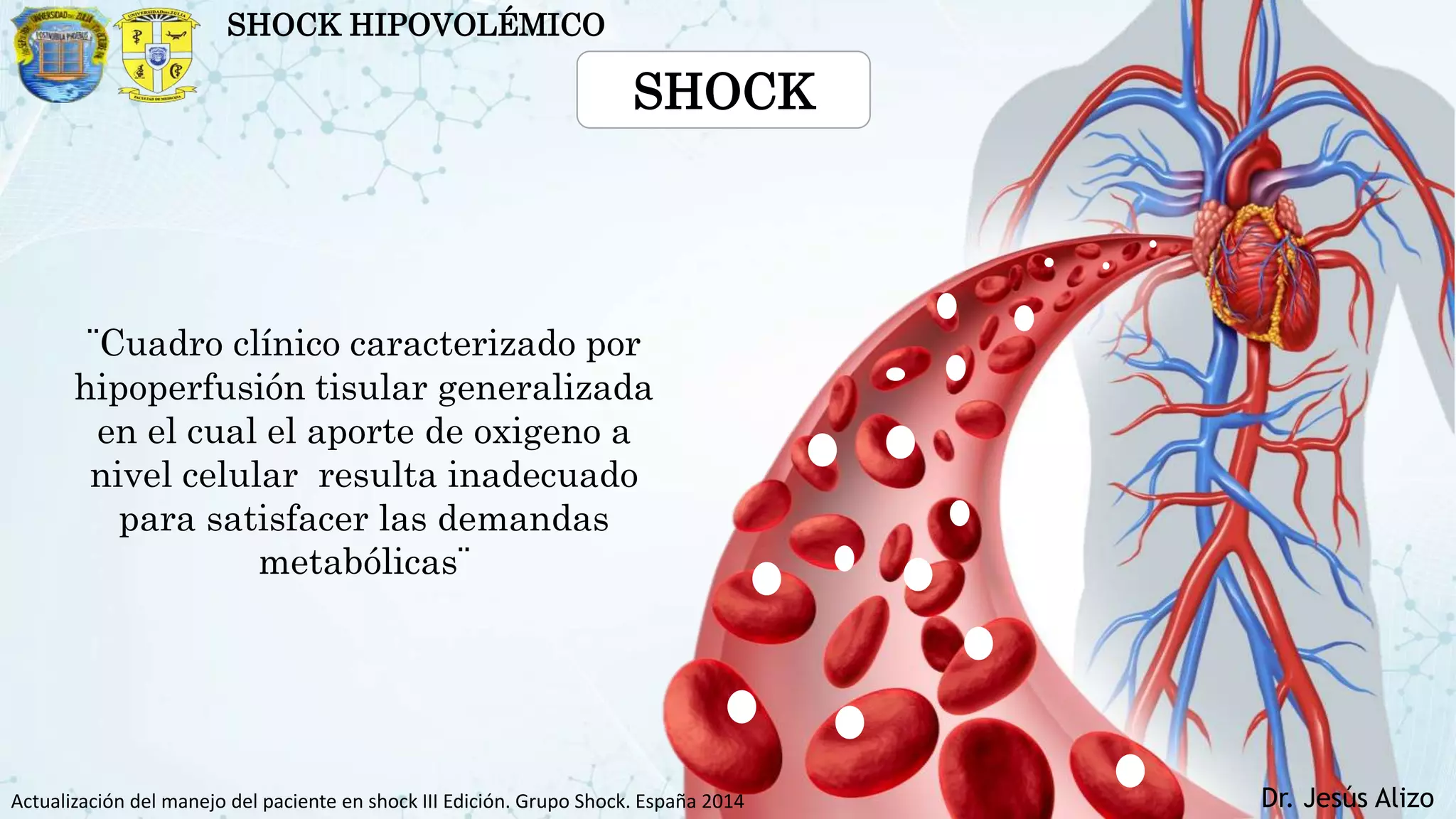 shock hipovolemico.pptx