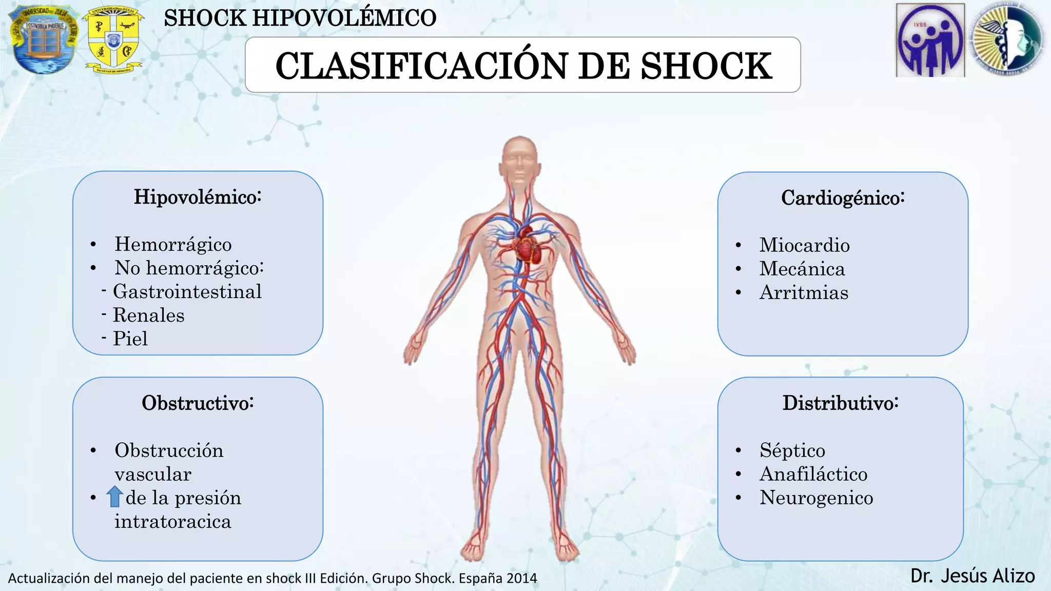 shock hipovolemico.pptx