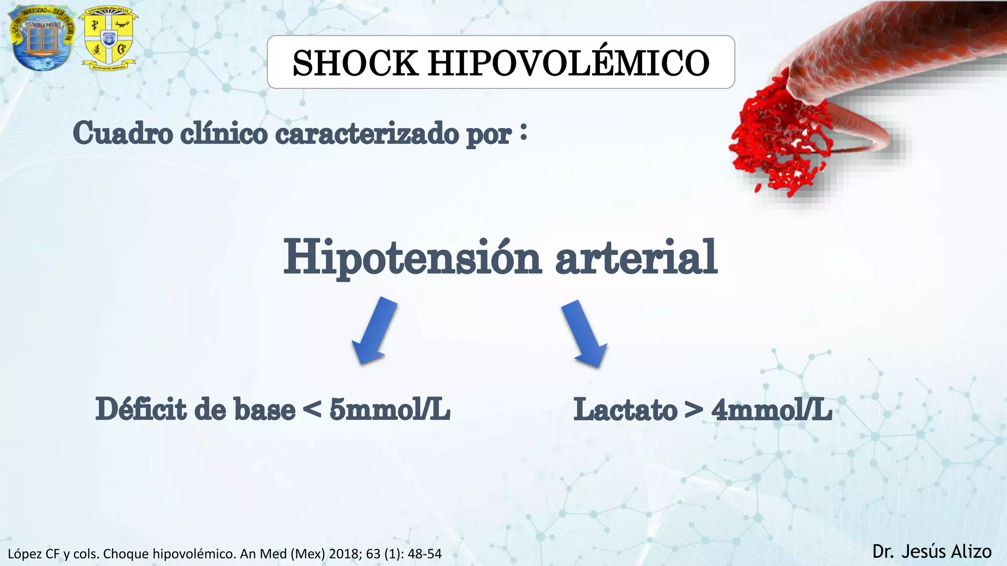 shock hipovolemico.pptx