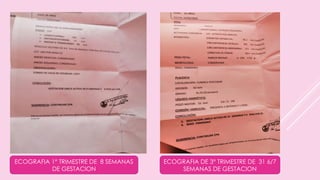 ECOGRAFIA 1° TRIMESTRE DE 8 SEMANAS
DE GESTACION
ECOGRAFIA DE 3° TRIMESTRE DE 31 6/7
SEMANAS DE GESTACION
 