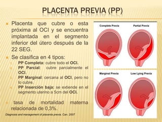 PLACENTA PREVIA (PP)
 Placenta que cubre o esta
próxima al OCI y se encuentra
implantada en el segmento
inferior del úter...