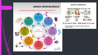 SHOCK HIPOVOLEMICO (1).pptx hipovolemico | PPTX