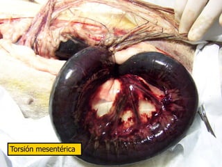 Torsión mesentérica
 