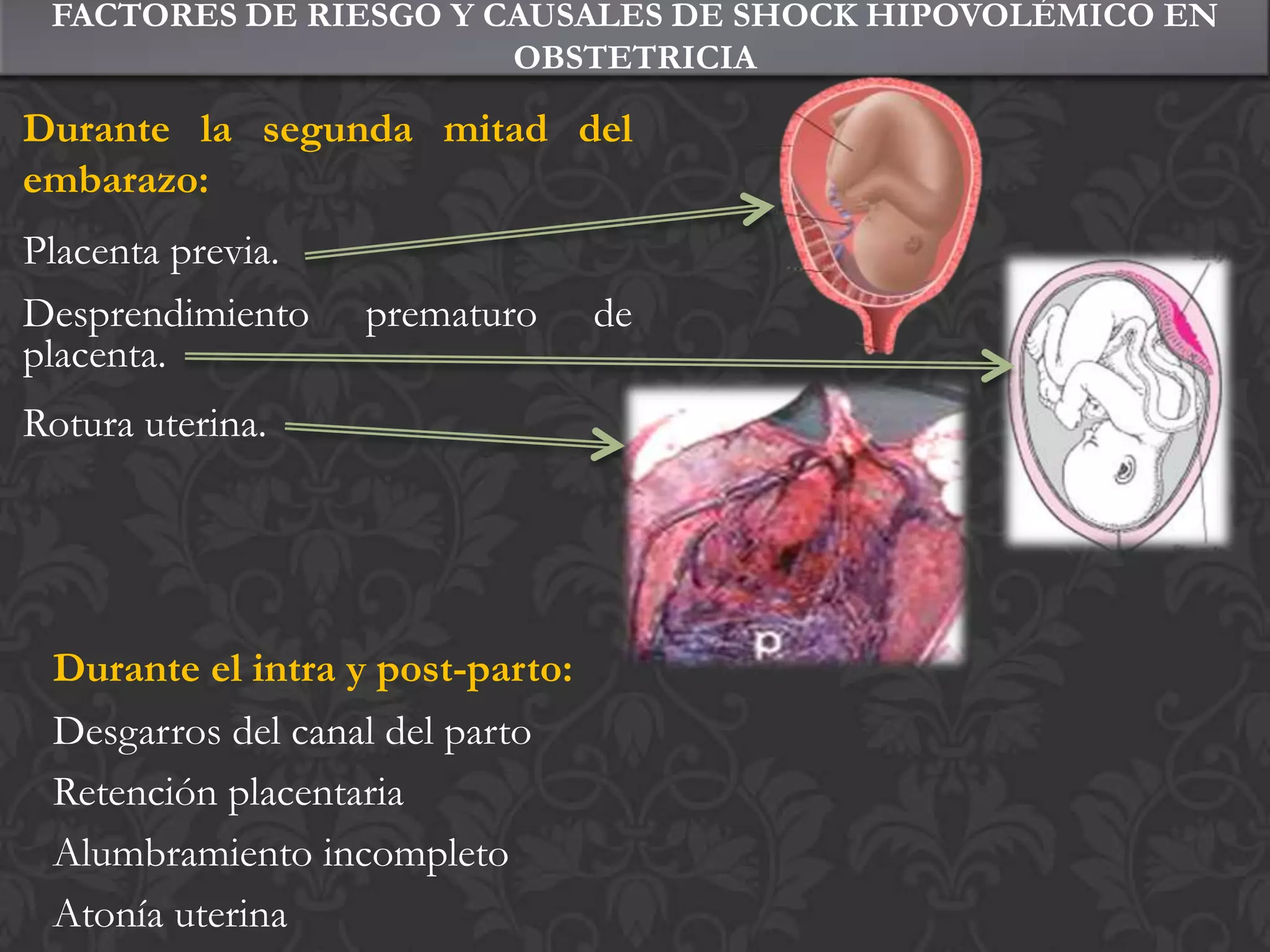 Shock hipovolémico en obstetricia | PPTX
