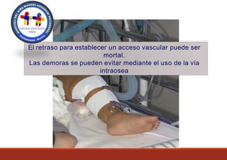 El retraso para establecer un acceso vascular puede ser
mortal.
Las demoras se pueden evitar mediante el uso de la vía
intraosea
 