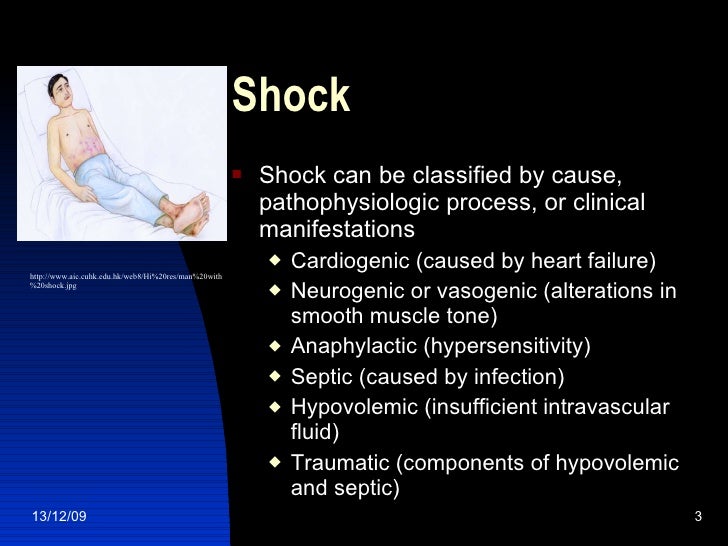 Shock in Adults and Children