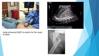 Shock in Trauma.pptx