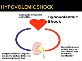 Shock its pathopysiology and management | PPTX