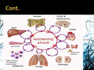 Shock its pathopysiology and management | PPTX