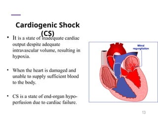 This is about Shock management by Jamal.pptx