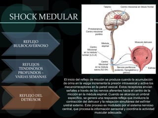 shock medular NEUROGENICO JOSE CRISTIAN VAIRO.pptx