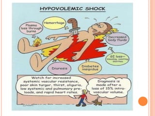 Shock (Circulatory shock) | PPTX