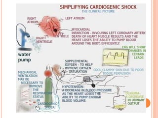 Shock Introduction Shock (Circulatory shock) | PPTX