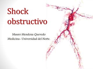 Shock
obstructivo
Mauro Mendoza Quevedo
Medicina- Universidad del Norte.
 