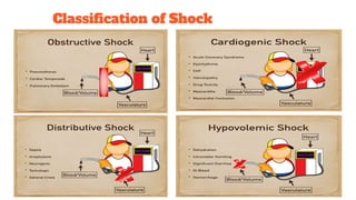 Classiﬁcation of Shock
 