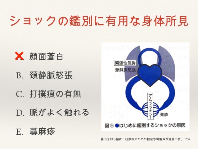 Shock Ppt Shock Ppt