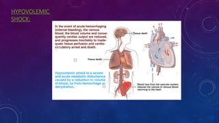 SHOCK PPT (2).pptx, types of shock and mgmt | PPTX