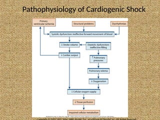 Pathophysiology of Cardiogenic Shock
 