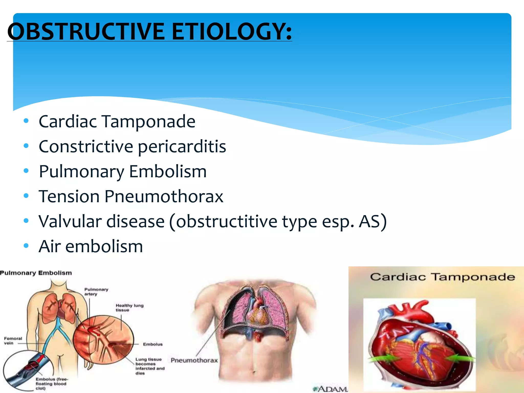 Shock its types and management | PPTX