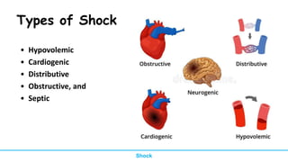 Types of Shock
• Hypovolemic
• Cardiogenic
• Distributive
• Obstructive, and
• Septic
Shock
 
