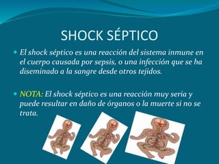 Shock séptico Daniela Colina | PPTX