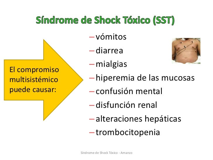 Shock tóxico pediatría_2011_isn