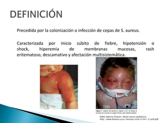 Precedida por la colonización o infección de cepas de S. aureus.
Caracterizada por inicio súbito de fiebre, hipotensión o
shock, hiperemia de membranas mucosas, rash
eritematoso, descamativo y afectación multisistemática.
Pablo Saborio Chacón. Shock toxico pediátrico.
http://www.binasss.sa.cr/revistas/rccm/v14n1-2/art8.pdf
 