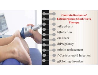 Extracorporeal shock wave therapy in physiotherapy | PDF