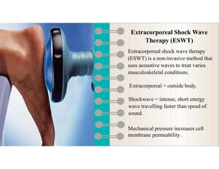 Extracorporeal shock wave therapy in physiotherapy | PDF