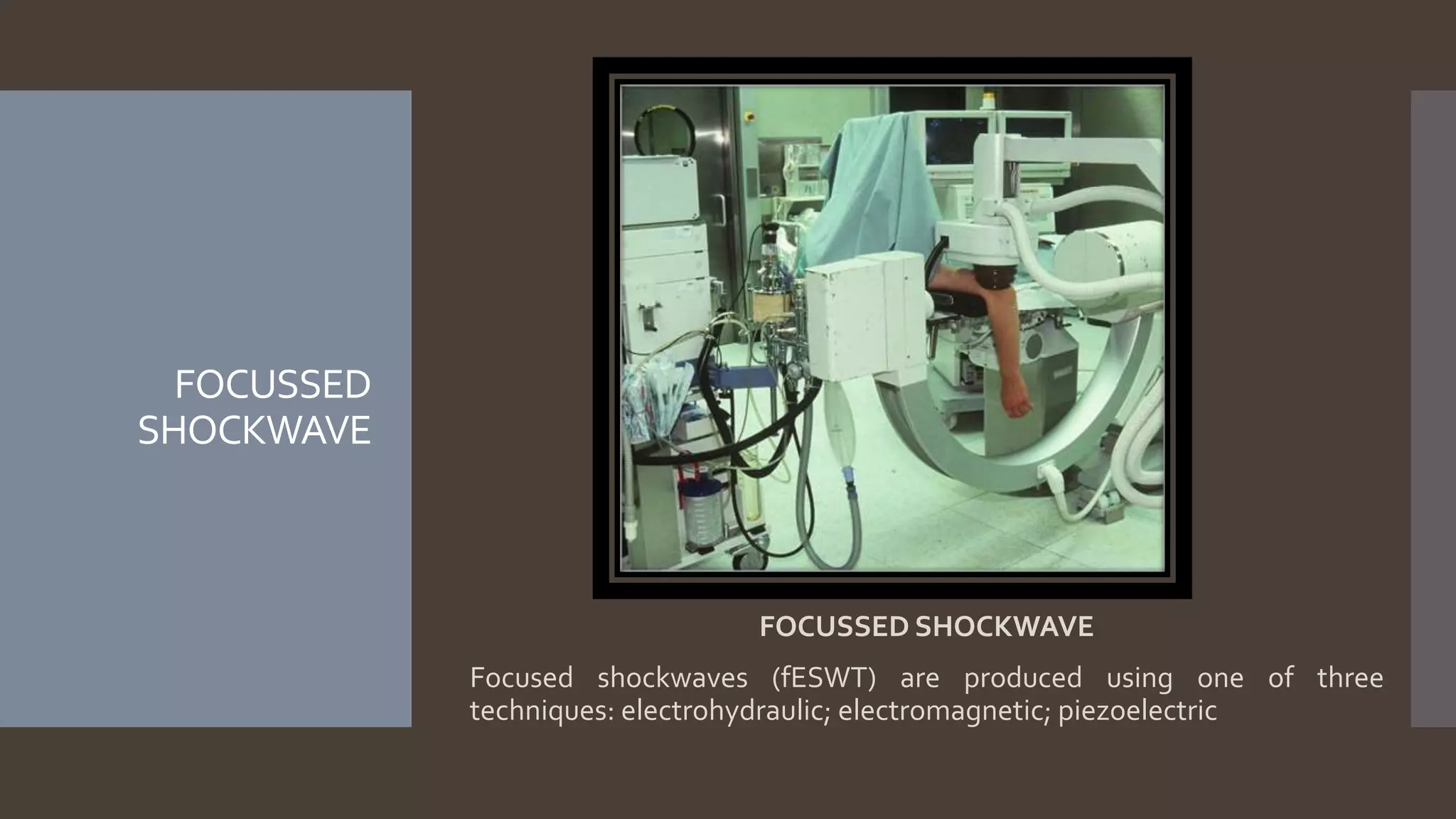 Shock wave therapy (swt) | PPTX