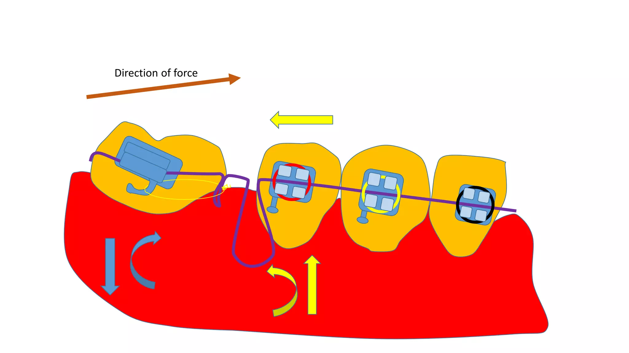 Direction of force