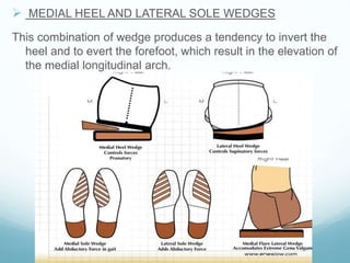  MEDIAL HEEL AND LATERAL SOLE WEDGES
This combination of wedge produces a tendency to invert the
heel and to evert the forefoot, which result in the elevation of
the medial longitudinal arch.
 
