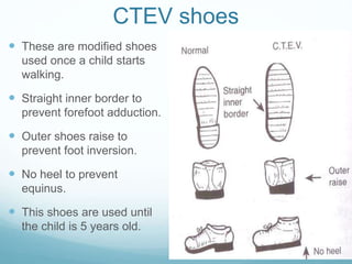 CTEV shoes
 These are modified shoes
used once a child starts
walking.
 Straight inner border to
prevent forefoot adduction.
 Outer shoes raise to
prevent foot inversion.
 No heel to prevent
equinus.
 This shoes are used until
the child is 5 years old.
 