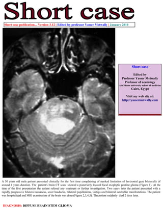 Short case publication... Version 3.12 | Edited by professor Yasser Metwally | January 2010




                                                                                                                 Short case

                                                                                                                 Edited by
                                                                                                         Professor Yasser Metwally
                                                                                                           Professor of neurology
                                                                                                      Ain Shams university school of medicine
                                                                                                                 Cairo, Egypt

                                                                                                            Visit my web site at:
                                                                                                         http://yassermetwally.com




A 50 years old male patient presented clinically for the first time complaining of marked limitation of horizontal gaze bilaterally of
around 4 years duration. The patient's brain CT scan showed a posteriorly located focal exophytic pontine glioma (Figure 1). At the
time of the first presentation the patient refused any treatment or further investigation. Two years later the patient presented with a
rapidly progressive bilateral weakness, sever headache, bilateral papilledema, vertigo and bilateral cerebellar manifestations. The patient
was hospitalized and MRI examination of the brain was done (Figure 2,3,4,5). The patient suddenly died 2 days later.


 DIAGNOSIS: DIFFUSE BRAIN STEM GLIOMA
 