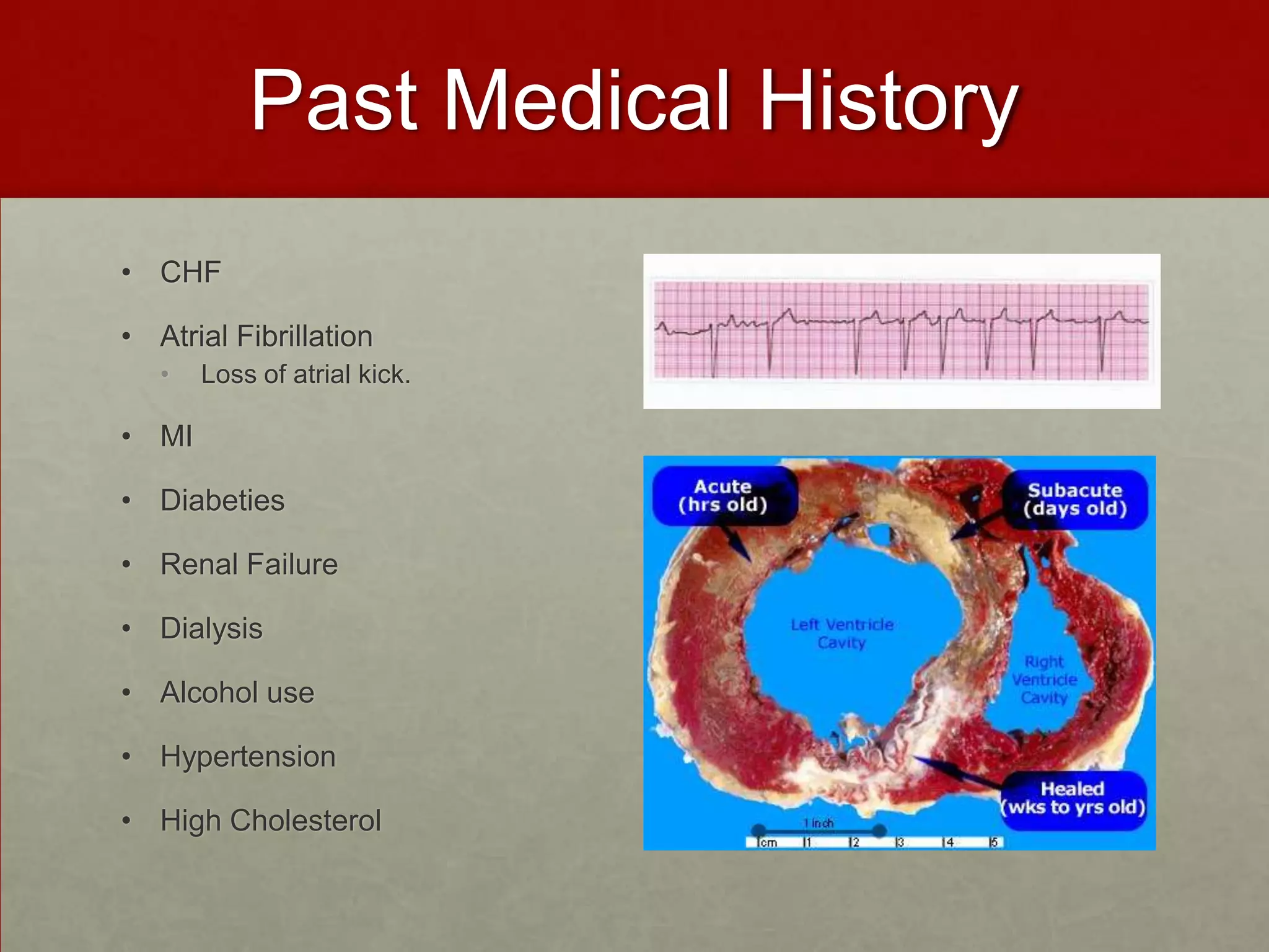 Past Medical History CHF Atrial FibrillationLoss of atrial kick.MI DiabetiesRenal Failure Dialysis Alcohol use HypertensionHigh Cholesterol 
