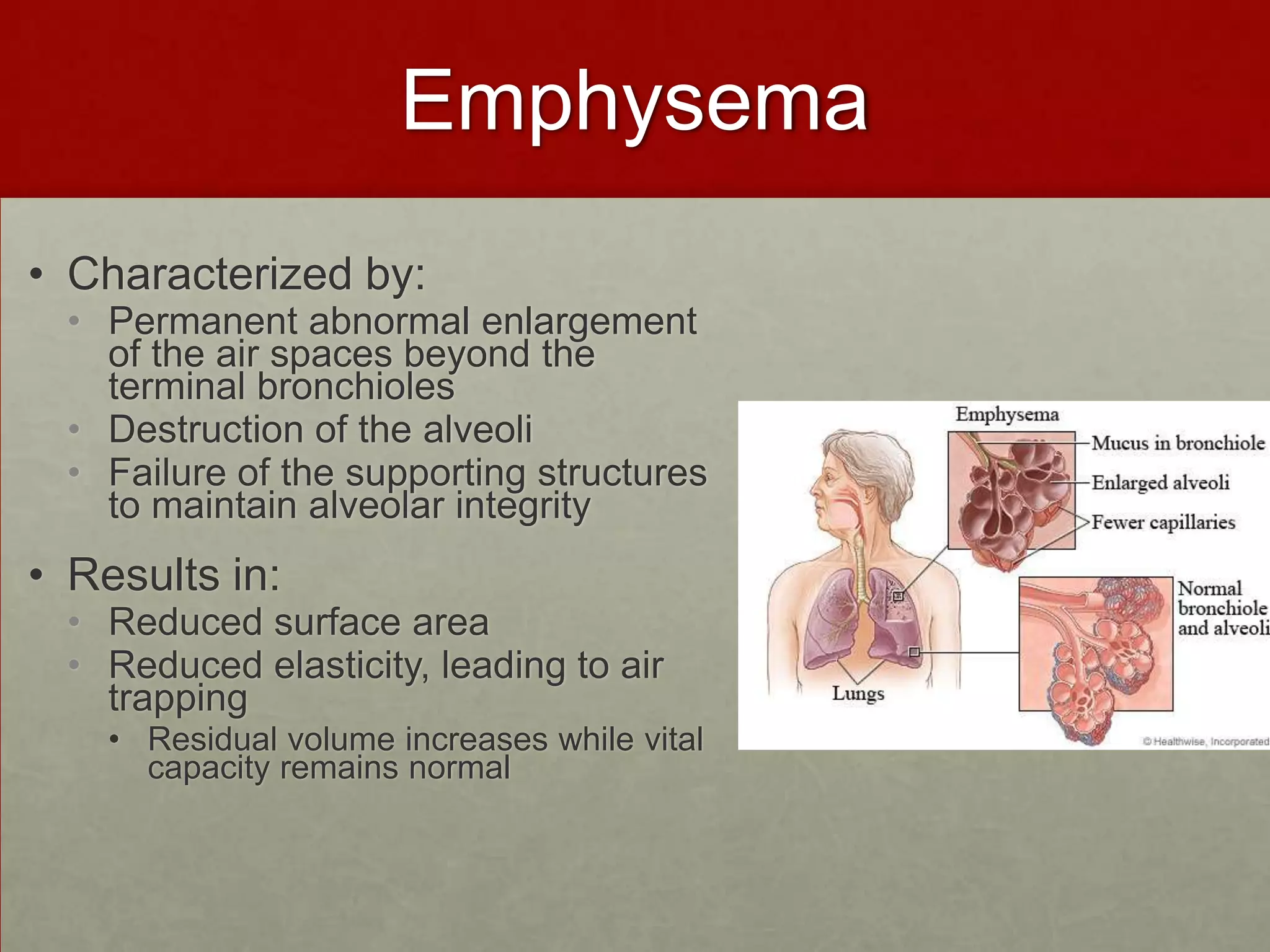 EmphysemaCharacterized by: Permanent abnormal enlargement of the air spaces beyond the terminal bronchiolesDestruction of the alveoli Failure of the supporting structures to maintain alveolar integrityResults in:Reduced surface area Reduced elasticity, leading to air trapping Residual volume increases while vital capacity remains normal 