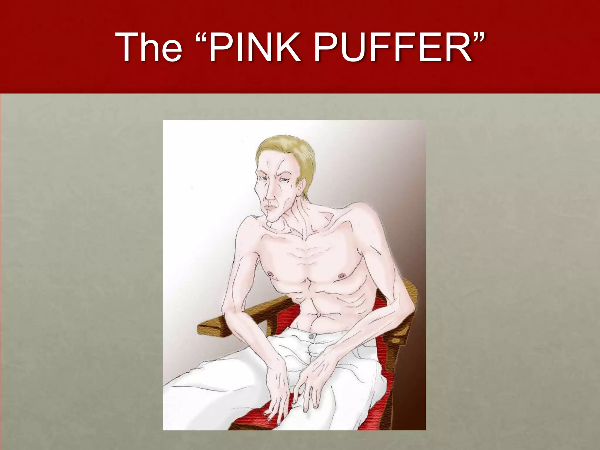 The “PINK PUFFER”