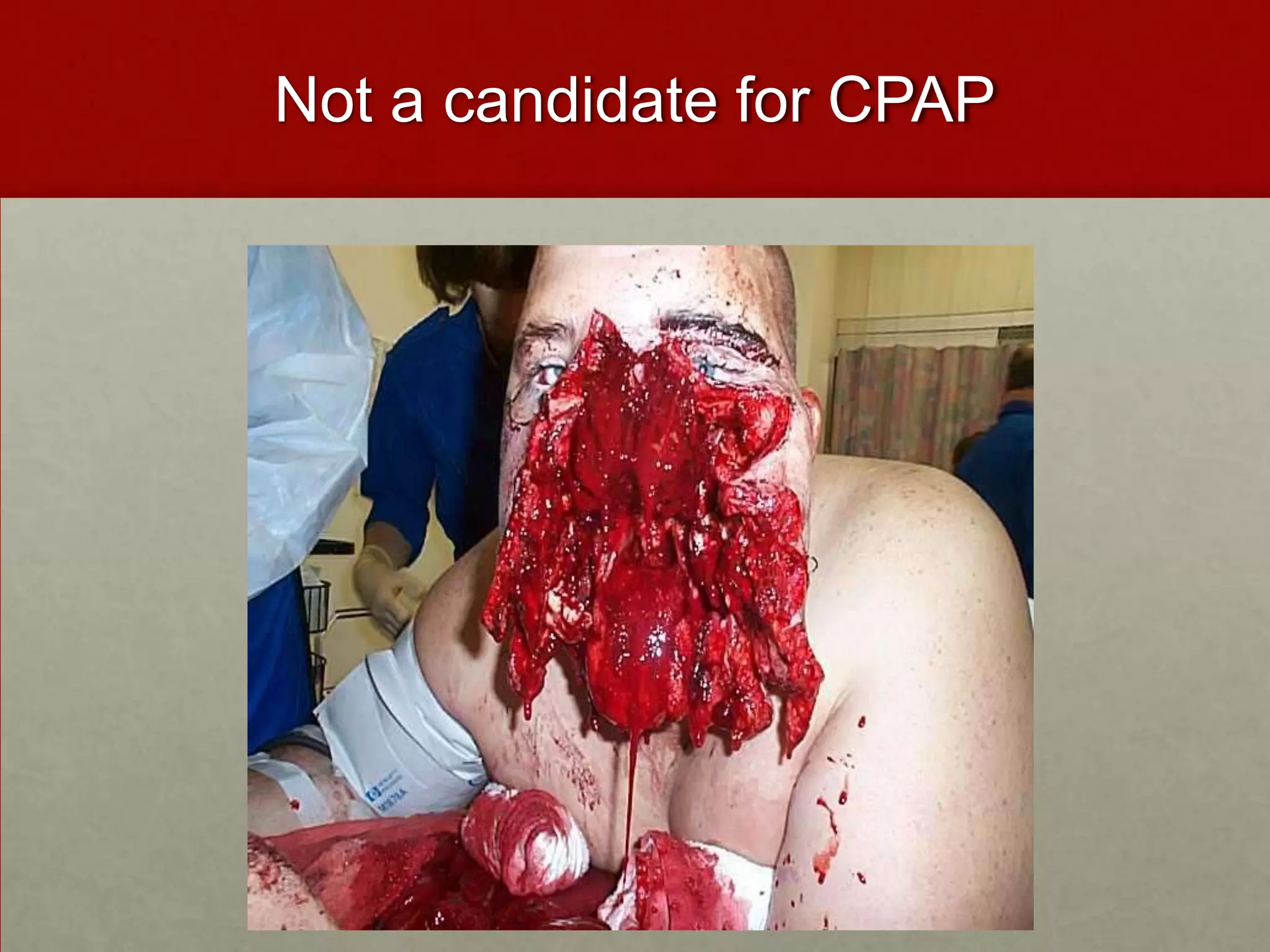 Not a candidate for CPAP
