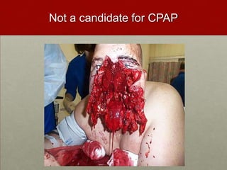Not a candidate for CPAP
