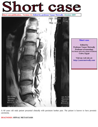 Short case publication... Version 3.1| Edited by professor Yasser Metwally | October 2009




                                                                                                Short case

                                                                                               Edited by
                                                                                       Professor Yasser Metwally
                                                                                         Professor of neurology
                                                                                     Ain Shams university school of medicine
                                                                                                Cairo, Egypt

                                                                                           Visit my web site at:
                                                                                        http://yassermetwally.com




A 60 years old male patient presented clinically with persistent lumbar pain. The patient is known to have prostatic
carcinoma.

DIAGNOSIS: SPINAL METASTASIS
 