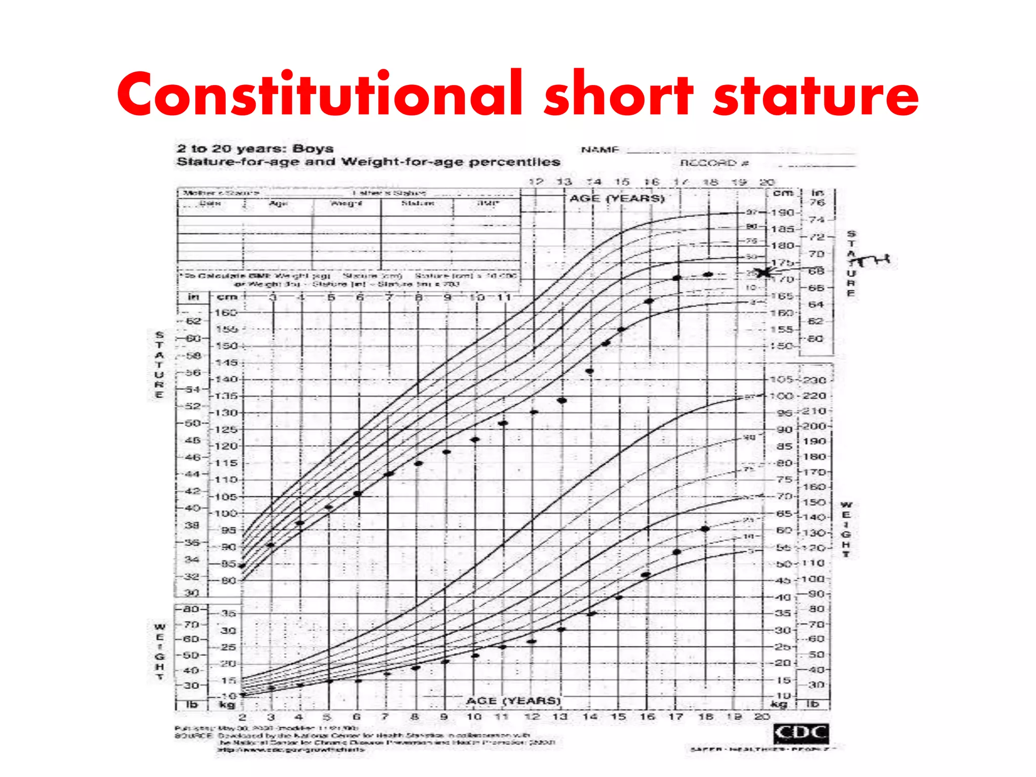 Short Stature