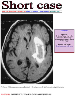 Short case publication... version 1.10 | Edited by professor Yasser Metwally | February 2008




                                                                                                        Short case

                                                                                                       Edited by
                                                                                               Professor Yasser Metwally
                                                                                                 Professor of neurology
                                                                                             Ain Shams university school of medicine
                                                                                                        Cairo, Egypt

                                                                                                  Visit my web site at:
                                                                                               http://yassermetwally.com




A 64 years old female patients presented clinically with sudden onset of right hemiplegia and global aphasia.



DIAGNOSIS: HYPERTENSIVE PUTAMENO-CAPSULAR HEMORRHAGE
 