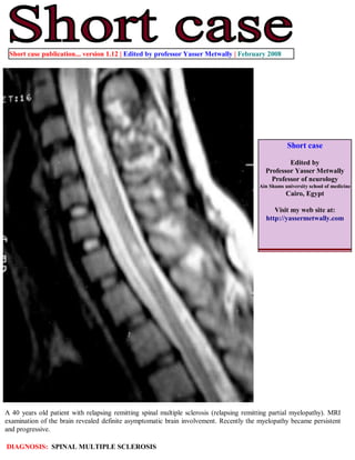 Short case publication... version 1.12 | Edited by professor Yasser Metwally | February 2008




                                                                                                     Short case

                                                                                                    Edited by
                                                                                            Professor Yasser Metwally
                                                                                              Professor of neurology
                                                                                          Ain Shams university school of medicine
                                                                                                     Cairo, Egypt

                                                                                               Visit my web site at:
                                                                                            http://yassermetwally.com




A 40 years old patient with relapsing remitting spinal multiple sclerosis (relapsing remitting partial myelopathy). MRI
examination of the brain revealed definite asymptomatic brain involvement. Recently the myelopathy became persistent
and progressive.

DIAGNOSIS: SPINAL MULTIPLE SCLEROSIS
 