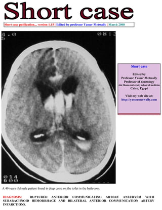 Short case publication... version 1.15 | Edited by professor Yasser Metwally | March 2008




                                                                                                Short case

                                                                                               Edited by
                                                                                       Professor Yasser Metwally
                                                                                         Professor of neurology
                                                                                     Ain Shams university school of medicine
                                                                                                Cairo, Egypt

                                                                                          Visit my web site at:
                                                                                       http://yassermetwally.com




A 40 years old male patient found in deep coma on the toilet in the bathroom.

DIAGNOSIS:   RUPTURED ANTERIOR COMMUNICATING ARTERY ANEURYSM WITH
SUBARACHNOID HEMORRHAGE AND BILATERAL ANTERIOR COMMUNICATION ARTERY
INFARCTIONS.
 