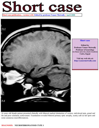 Short case publication... version 1.18 | Edited by professor Yasser Metwally | April 2008




                                                                                                      Short case

                                                                                                     Edited by
                                                                                             Professor Yasser Metwally
                                                                                               Professor of neurology
                                                                                           Ain Shams university school of medicine
                                                                                                      Cairo, Egypt

                                                                                                 Visit my web site at:
                                                                                              http://yassermetwally.com




16 years old female patient presented clinically with bilateral marked diminution of version, mid-dorsal pain, grand mal
fits and poor scholastic achievement. Examination revealed bilateral primary optic atrophy, scanty café au lait spots and
some cutaneous neurofibromatosis.


DIAGNOSIS: NEUROFIBROMATOSIS TYPE 1
 